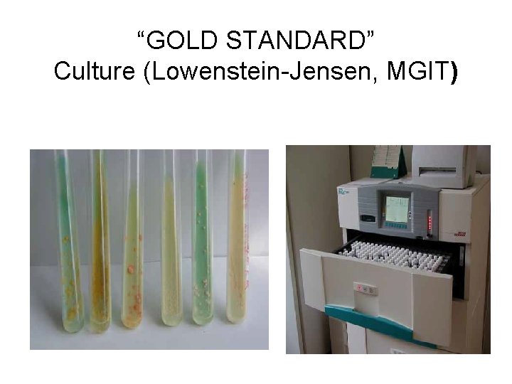 “GOLD STANDARD” Culture (Lowenstein-Jensen, MGIT) 