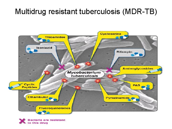 Multidrug resistant tuberculosis (MDR-TB) 