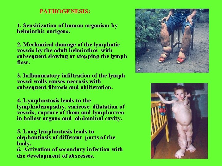 PATHOGENESIS: 1. Sensitization of human organism by helminthic antigens. 2. Mechanical damage of the