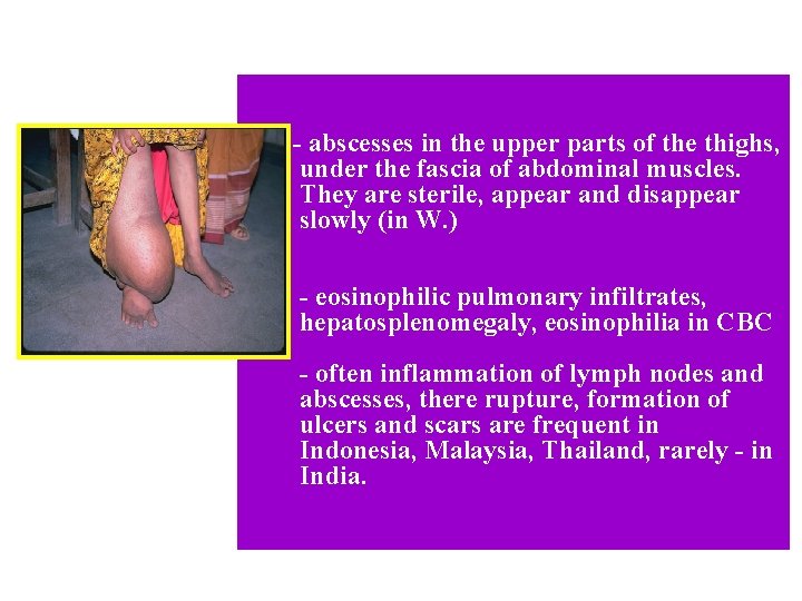 - - - abscesses in the upper parts of the thighs, under the fascia