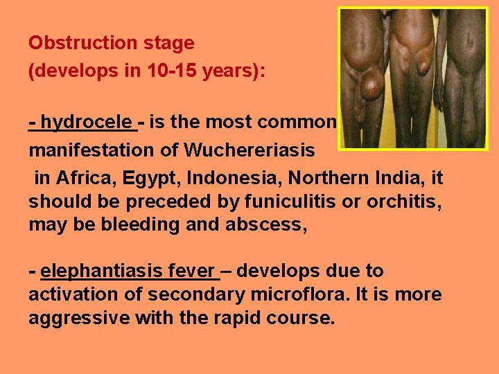 Obstruction stage (develops in 10 -15 years): - hydrocele - is the most common
