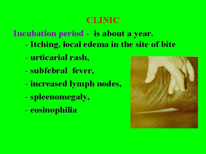 CLINIC Incubation period - is about a year. - Itching, local edema in the