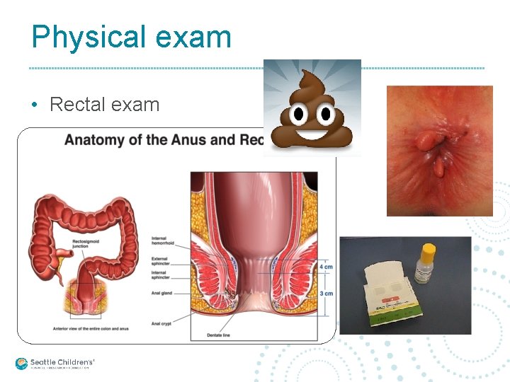 Physical exam • Rectal exam 
