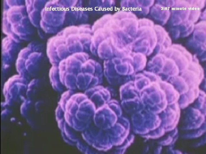 Infectious Diseases Caused by Bacteria 3: 07 minute video 