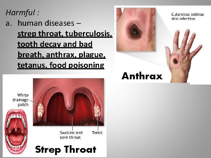 Harmful : a. human diseases – strep throat, tuberculosis, tooth decay and bad breath,