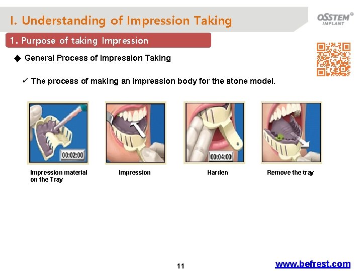 I. Understanding of Impression Taking 1. Purpose of taking Impression ◆ General Process of