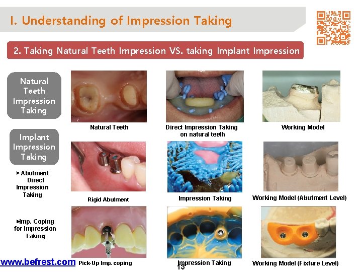 I. Understanding of Impression Taking 2. Taking Natural Teeth Impression VS. taking Implant Impression