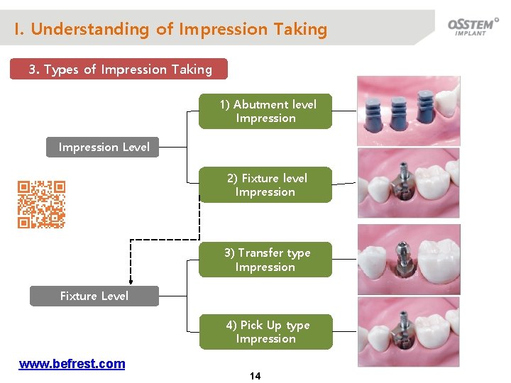 I. Understanding of Impression Taking 3. Types of Impression Taking 1) Abutment level Impression