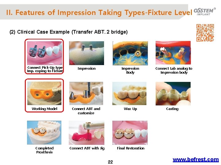 II. Features of Impression Taking Types-Fixture Level (2) Clinical Case Example (Transfer ABT. 2