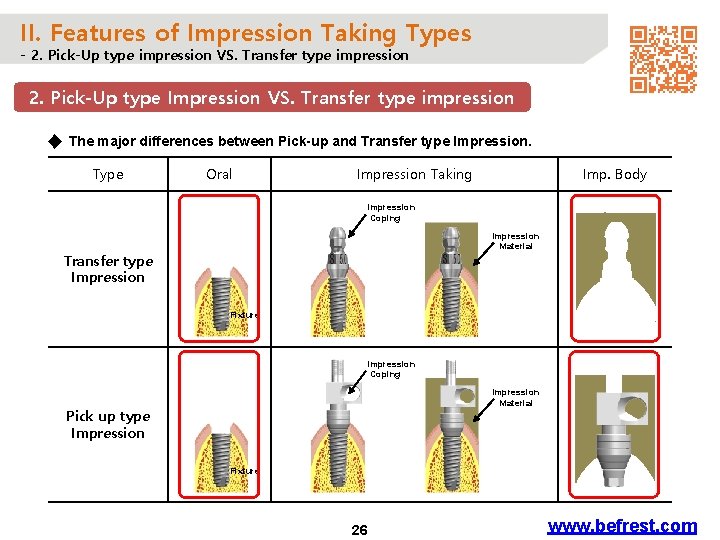 II. Features of Impression Taking Types - 2. Pick-Up type impression VS. Transfer type