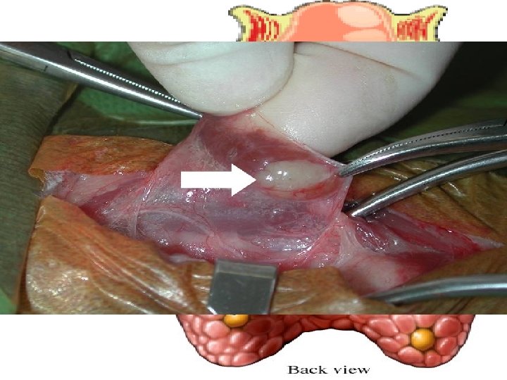 Parathyroid The parathyroid gland produces parathormone which controls calcium levels in the body. 