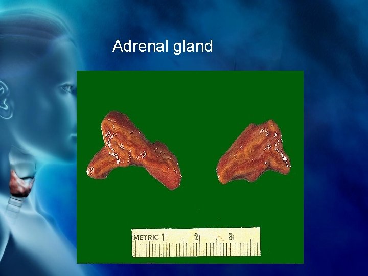 Adrenal gland 