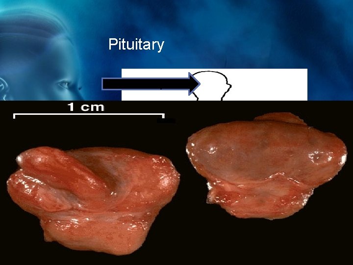 Pituitary The pituitary gland produces a growth hormone which controls growth and homeostasis. 