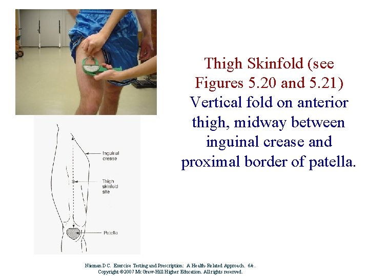 Thigh Skinfold (see Figures 5. 20 and 5. 21) Vertical fold on anterior thigh,