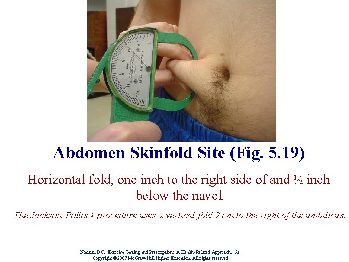 Abdomen Skinfold Site (Fig. 5. 19) Horizontal fold, one inch to the right side