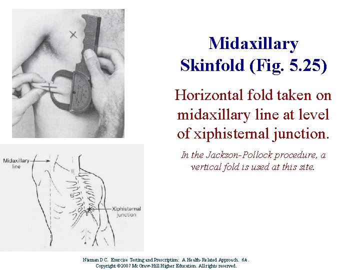 Midaxillary Skinfold (Fig. 5. 25) Horizontal fold taken on midaxillary line at level of