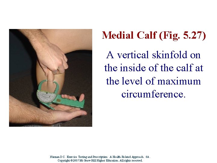 Medial Calf (Fig. 5. 27) A vertical skinfold on the inside of the calf