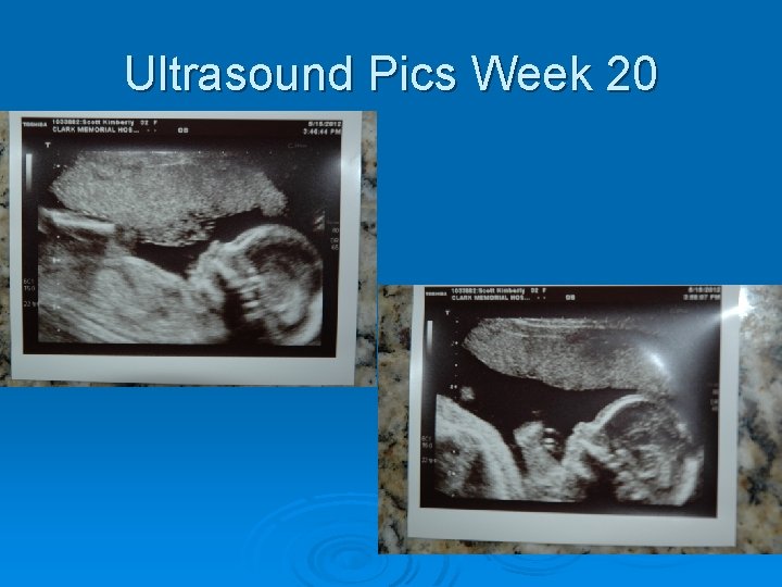 Ultrasound Pics Week 20 