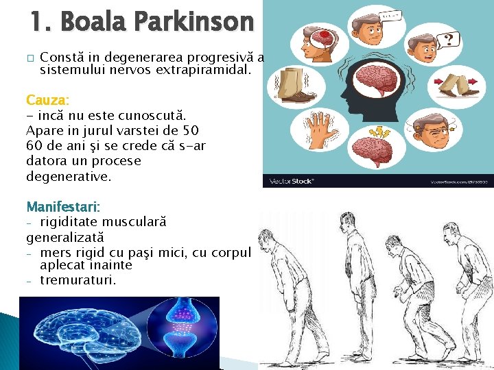 1. Boala Parkinson � Constă in degenerarea progresivă a sistemului nervos extrapiramidal. Cauza: -