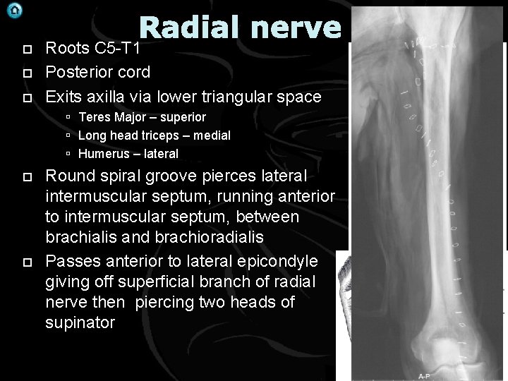  Radial nerve Roots C 5 -T 1 Posterior cord Exits axilla via lower