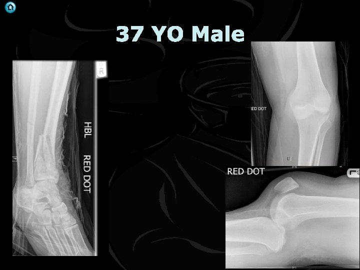 37 YO Male 