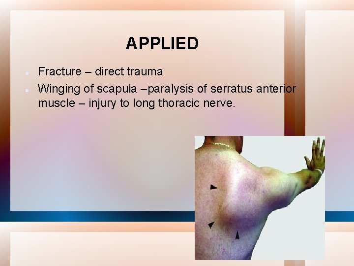 APPLIED Fracture – direct trauma Winging of scapula –paralysis of serratus anterior muscle –