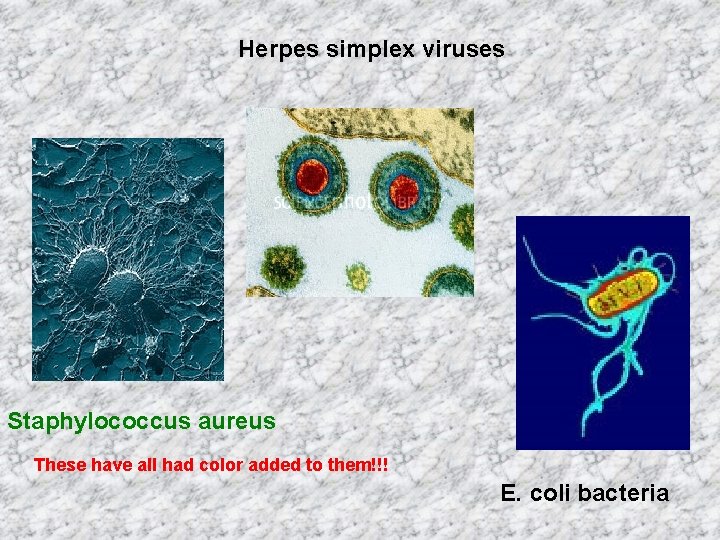 Herpes simplex viruses Staphylococcus aureus These have all had color added to them!!! E.