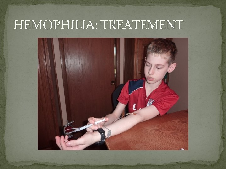 HEMOPHILIA: TREATEMENT 
