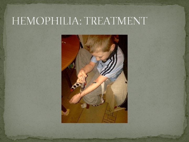 HEMOPHILIA: TREATMENT 