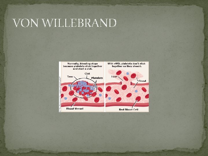 VON WILLEBRAND 