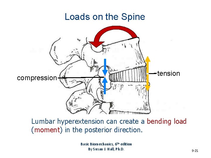Loads on the Spine tension compression Lumbar hyperextension can create a bending load (moment)