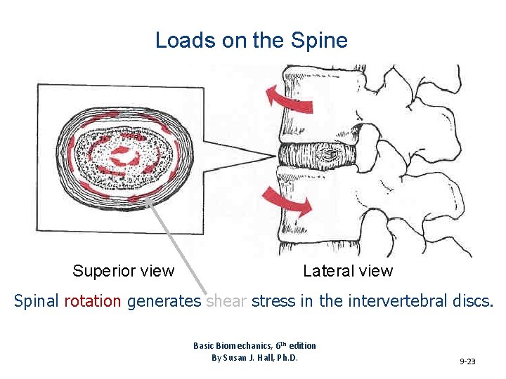 Loads on the Spine Superior view Lateral view Spinal rotation generates shear stress in