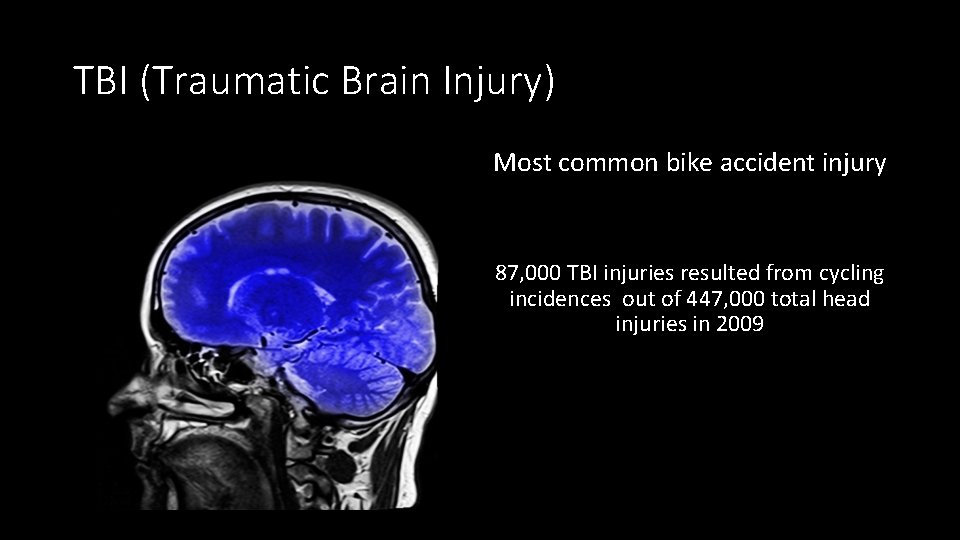 TBI (Traumatic Brain Injury) Most common bike accident injury 87, 000 TBI injuries resulted