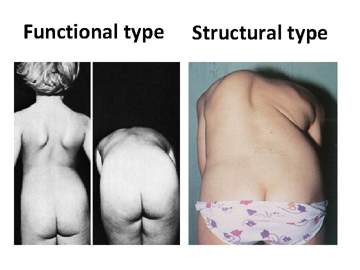 Functional type Structural type 