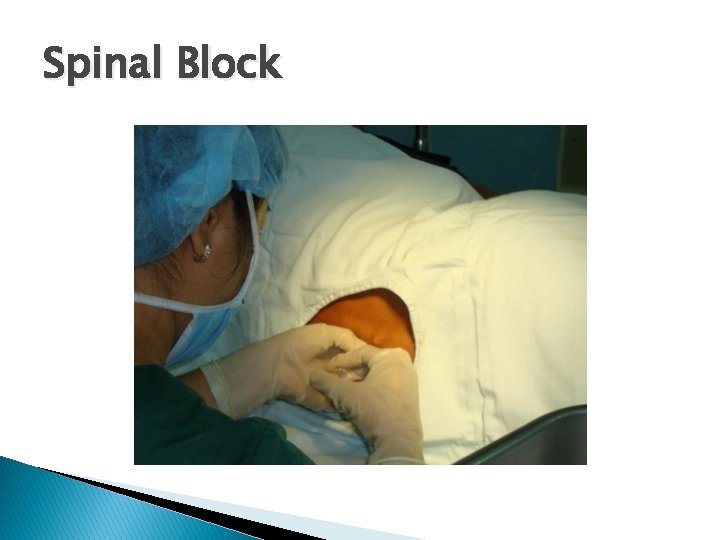 Spinal Block 