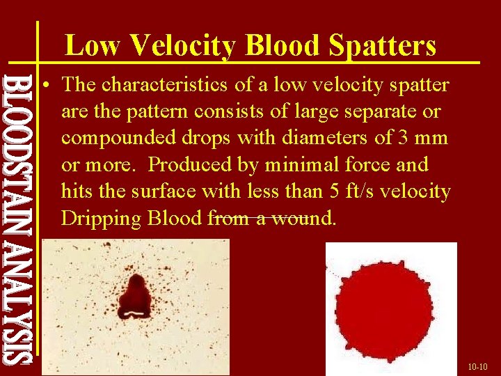 Low Velocity Blood Spatters • The characteristics of a low velocity spatter are the