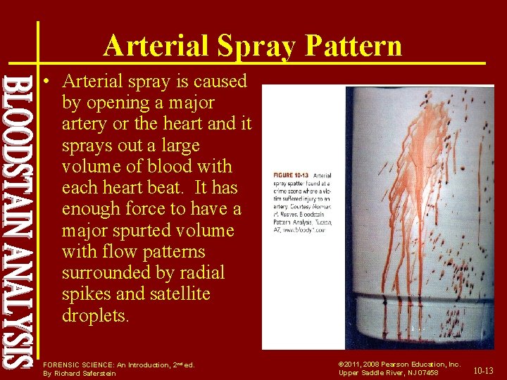 Arterial Spray Pattern • Arterial spray is caused by opening a major artery or