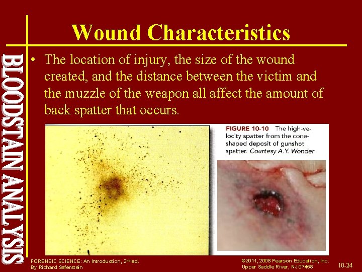 Wound Characteristics • The location of injury, the size of the wound created, and