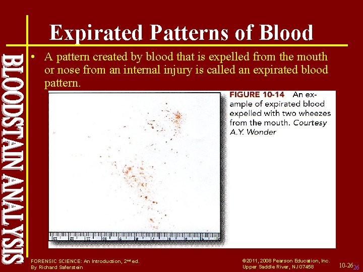 Expirated Patterns of Blood • A pattern created by blood that is expelled from