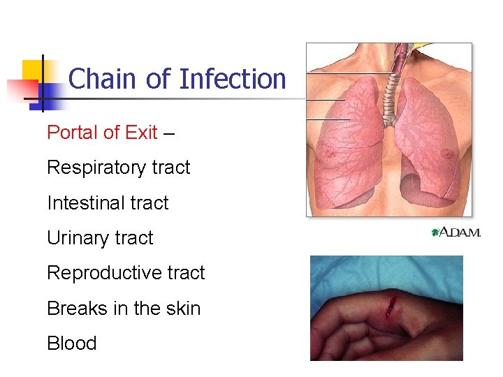 Chain of Infection Portal of Exit – Respiratory tract Intestinal tract Urinary tract Reproductive