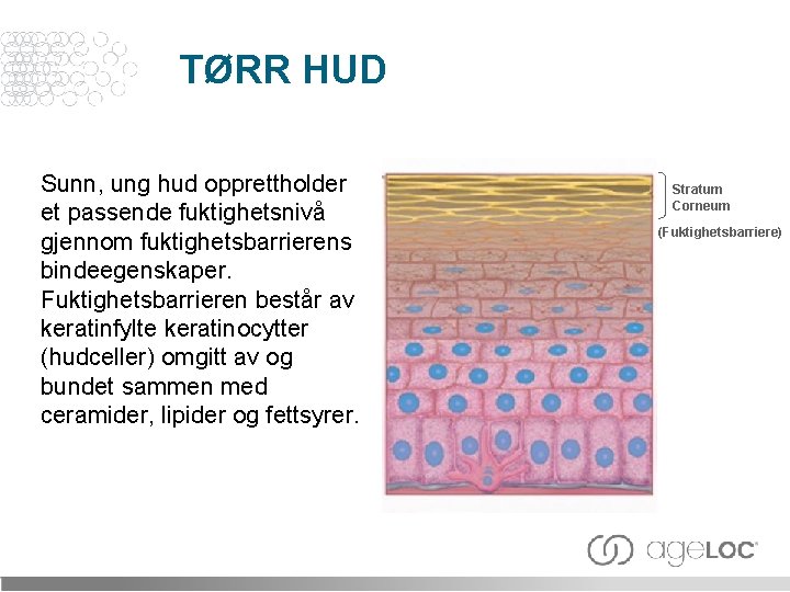 TØRR HUD Sunn, ung hud opprettholder et passende fuktighetsnivå gjennom fuktighetsbarrierens bindeegenskaper. Fuktighetsbarrieren består