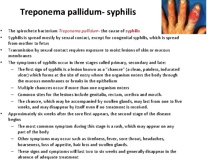 Treponema pallidum- syphilis • • • The spirochete bacterium Treponema pallidum- the cause of
