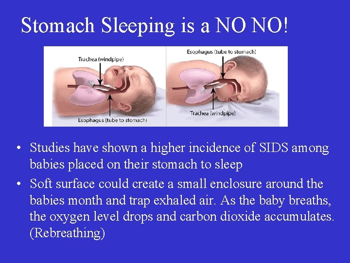 Stomach Sleeping is a NO NO! • Studies have shown a higher incidence of