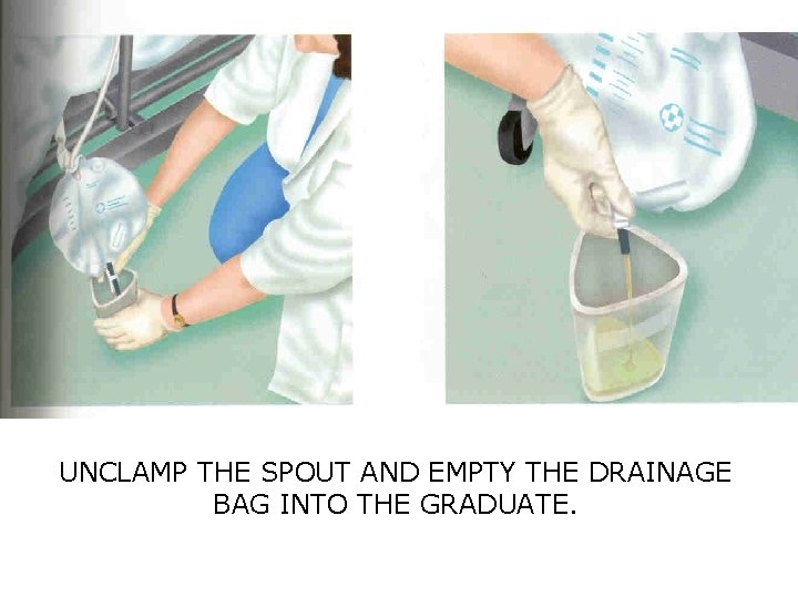 UNCLAMP THE SPOUT AND EMPTY THE DRAINAGE BAG INTO THE GRADUATE. 