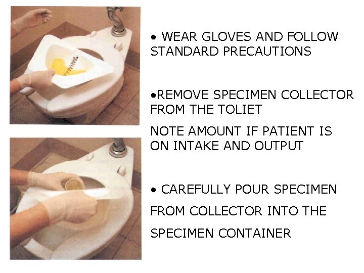  • WEAR GLOVES AND FOLLOW STANDARD PRECAUTIONS • REMOVE SPECIMEN COLLECTOR FROM THE