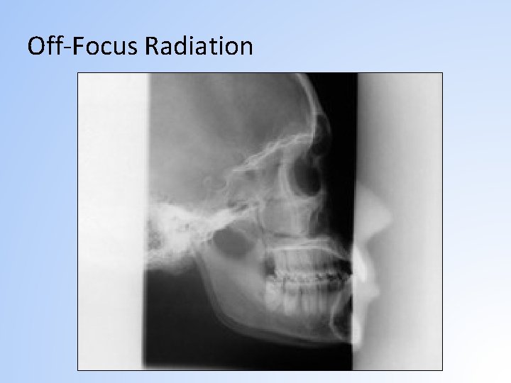 Off-Focus Radiation 