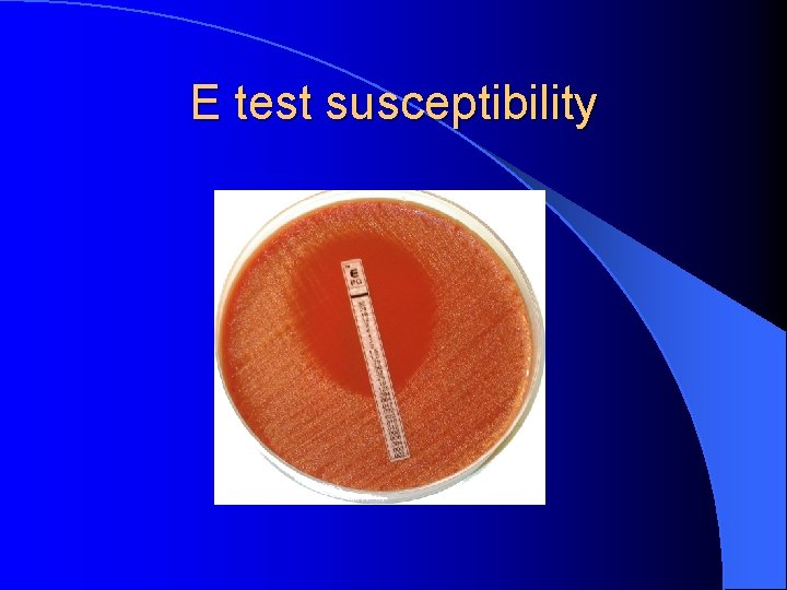E test susceptibility 