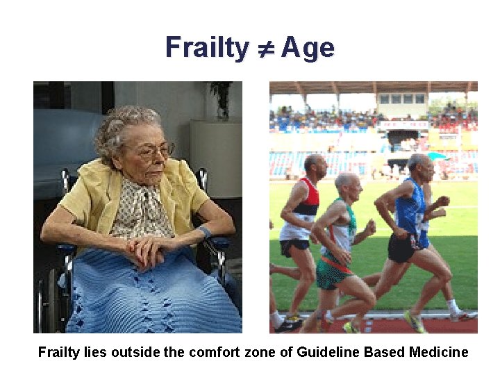 Frailty Age Frailty lies outside the comfort zone of Guideline Based Medicine 