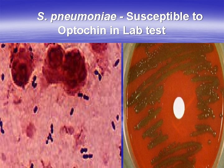 S. pneumoniae - Susceptible to Optochin in Lab test 