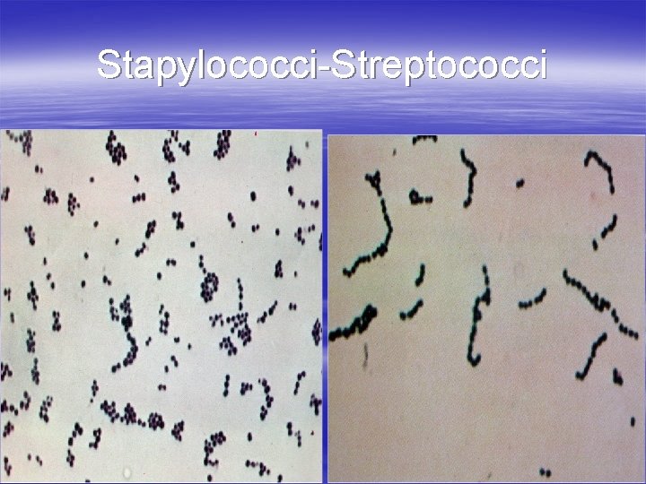 Stapylococci-Streptococci 